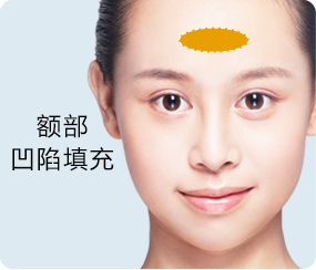 美无痕·爱无限_长曲线下颌角整形|下颌角整形