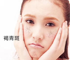 美无痕·爱无限_色素色斑治疗中心_南京医科